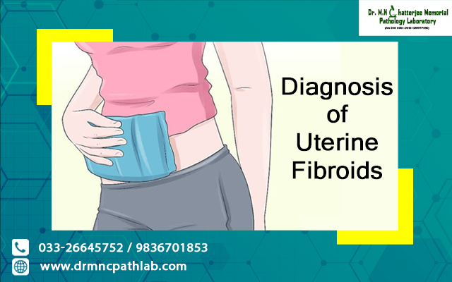 Diagnosis of Uterine Fibroids