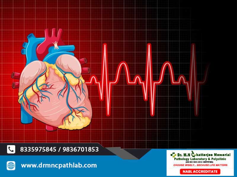 All You Need to Know about Cardiac Arrest